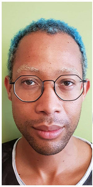 Before treatment