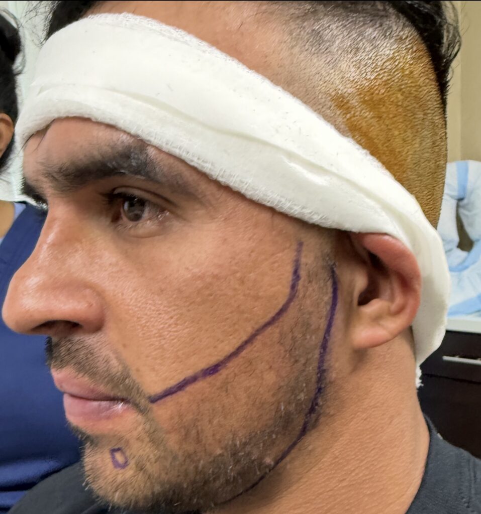 Before treatment